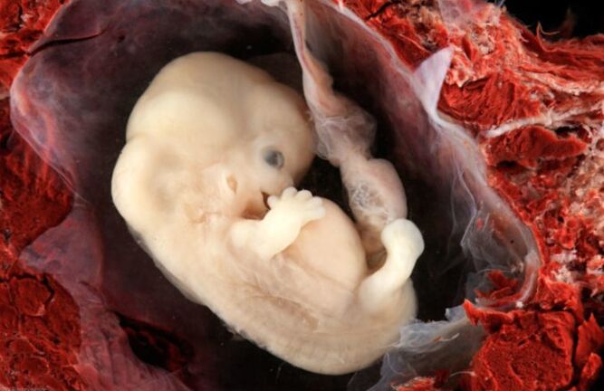Pathologien vum Fetus si méiglech
